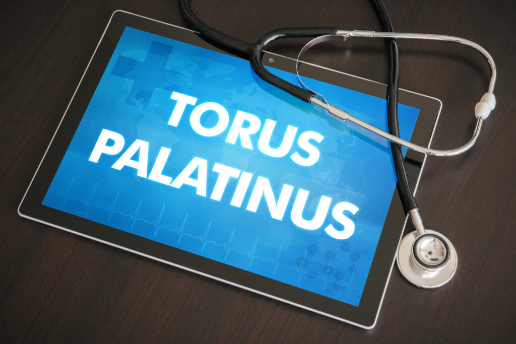 Do You Need Tori Removal? Understanding When It’s Time to Consider Surgery